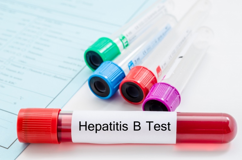 Hepatitis-B test