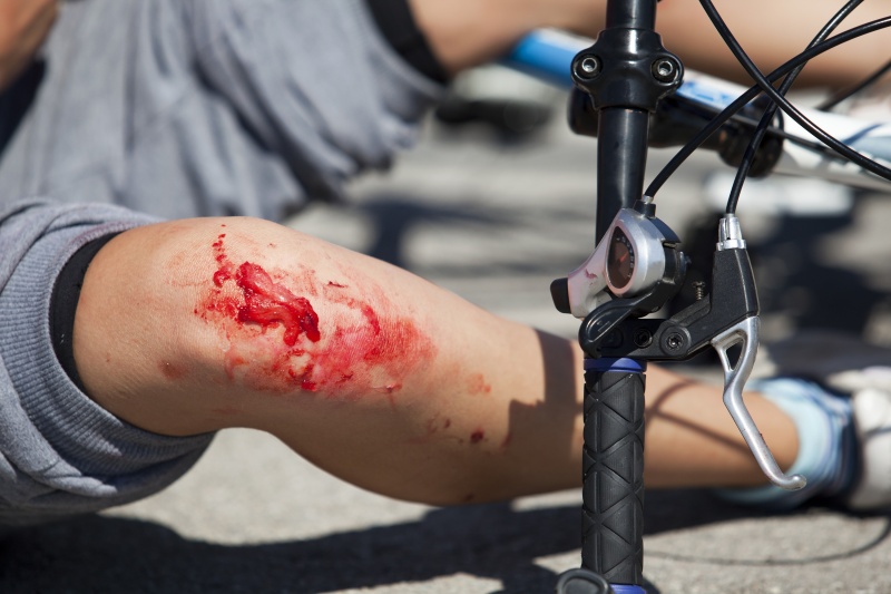 letselschade verkeer fietser