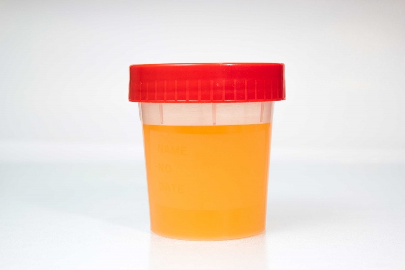 Donkere urine