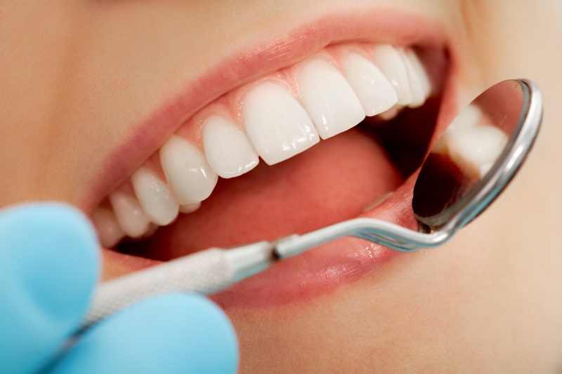8 tips voor een betere mondverzorging